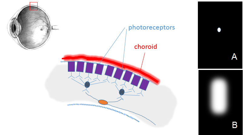 section through upper side of retina with several purple rod-shaped cells. Choice A shows a sharp white light; choice B shows a blurry white blob.