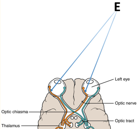 diagram of optic tracts, showing that fibers from the nasal side of each retina cross to the opposite side of the brain while fibers from the lateral side of each retina go straight back to the same side of the brain. both eyes are looking at an 'E' to the right.