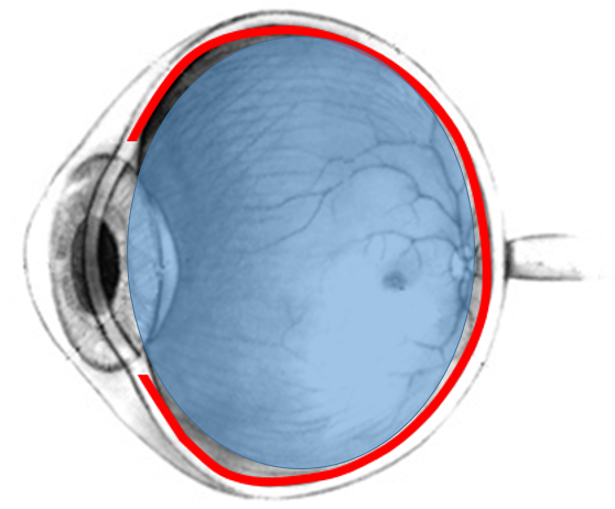 lateral view of eye with posterior chamber colored